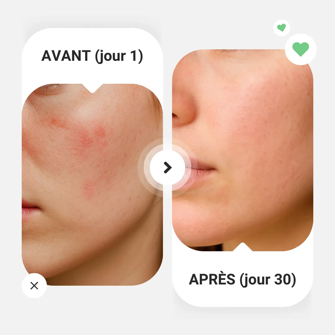 Soin visage La crème sans eau